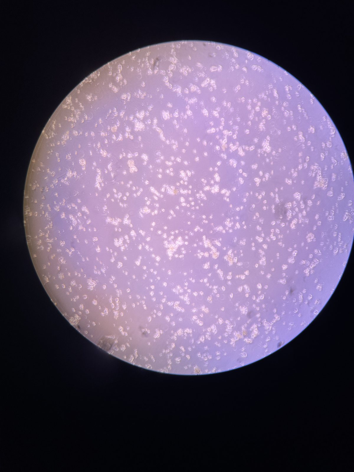 A microscope field of view, cells scattered as pale dots across a lilac background